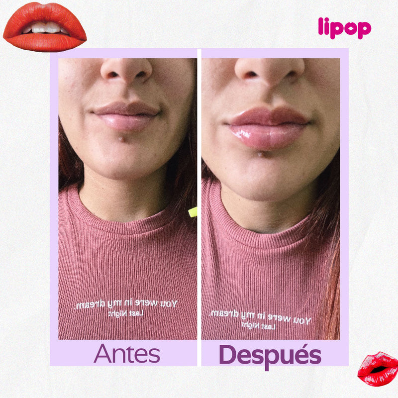 💄✨ LIPOP® - VOLUMINIZADOR DE LABIOS INSTANTÁNEO ✨💄